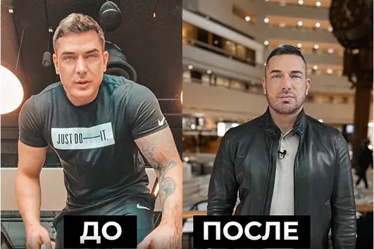 Пересадка волос Курбан Омаров. Статья от ГорМедЦентра