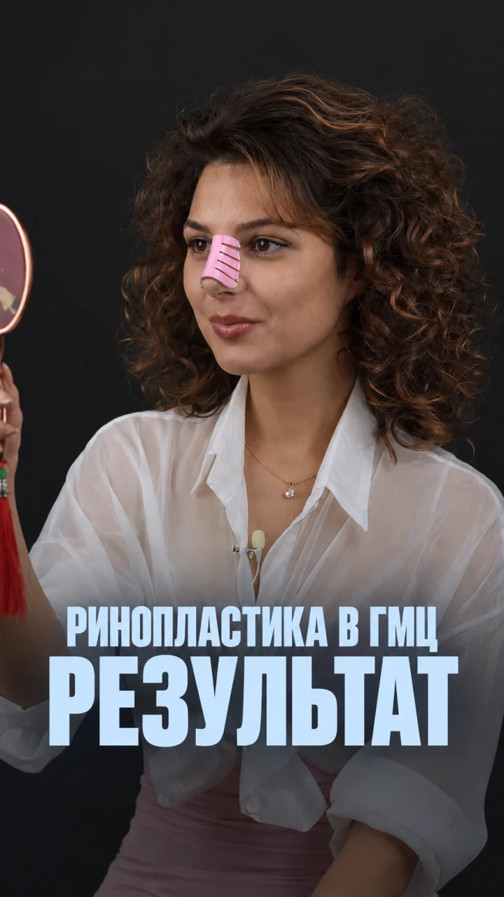 Пациентка с зеркалом после ринопластики в ГМЦ — результат