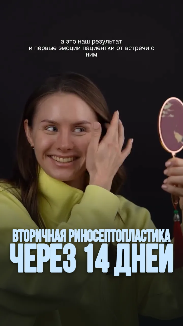 Пациентка с зеркалом через 14 дней после вторичной риносептопластики