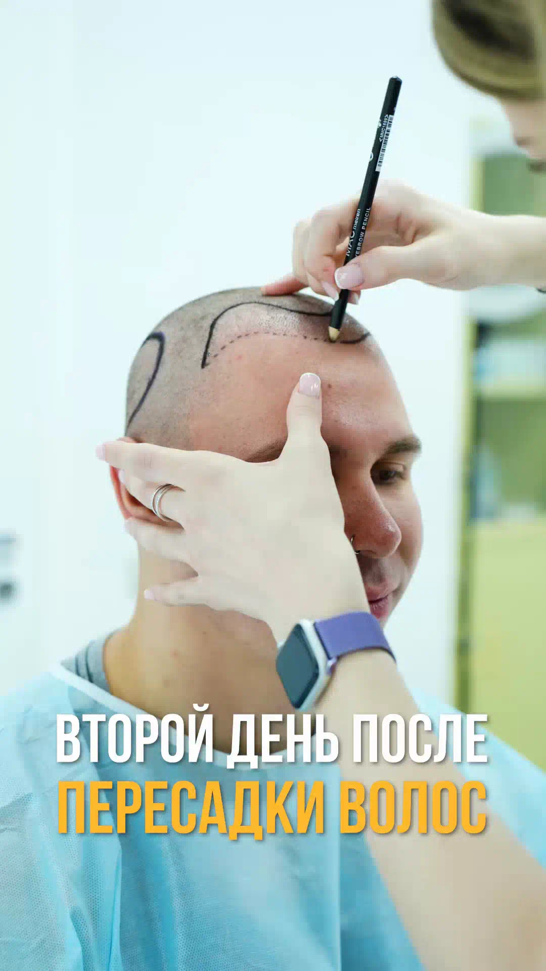 Ролик клиники ГМЦ о пересадке волос