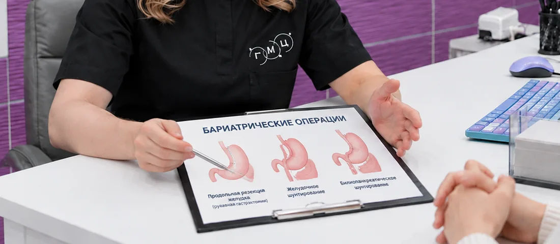 Врач показывает пациентке на листе виды бариатрических операций