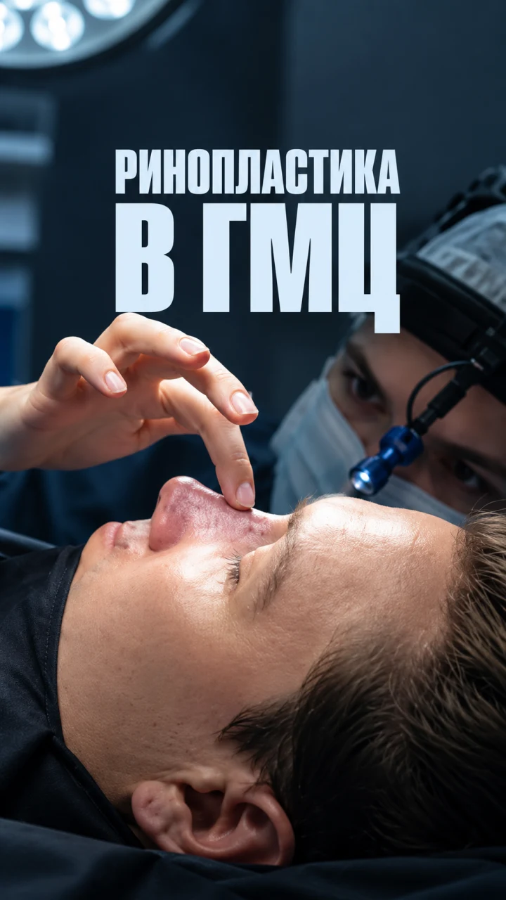 Пациент на осмотре носа в ГМЦ — история ринопластики