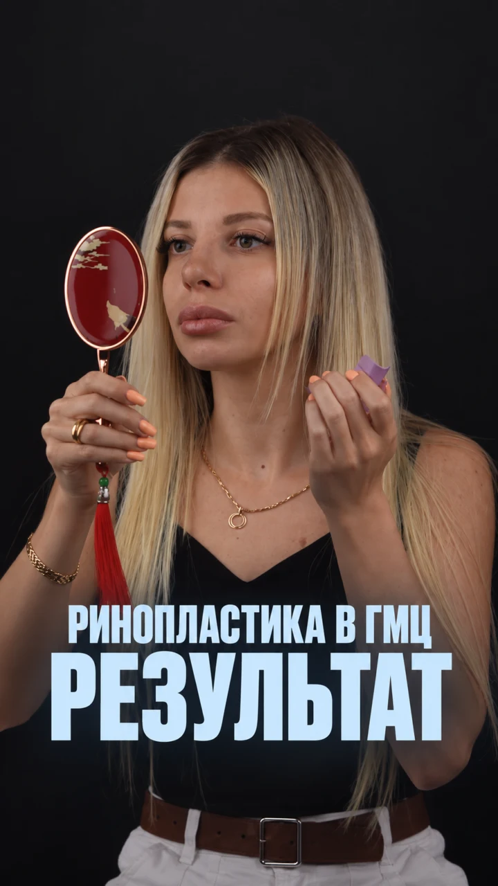 Пациентка с зеркалом сразу после снятия лонгеты — результат ринопластики