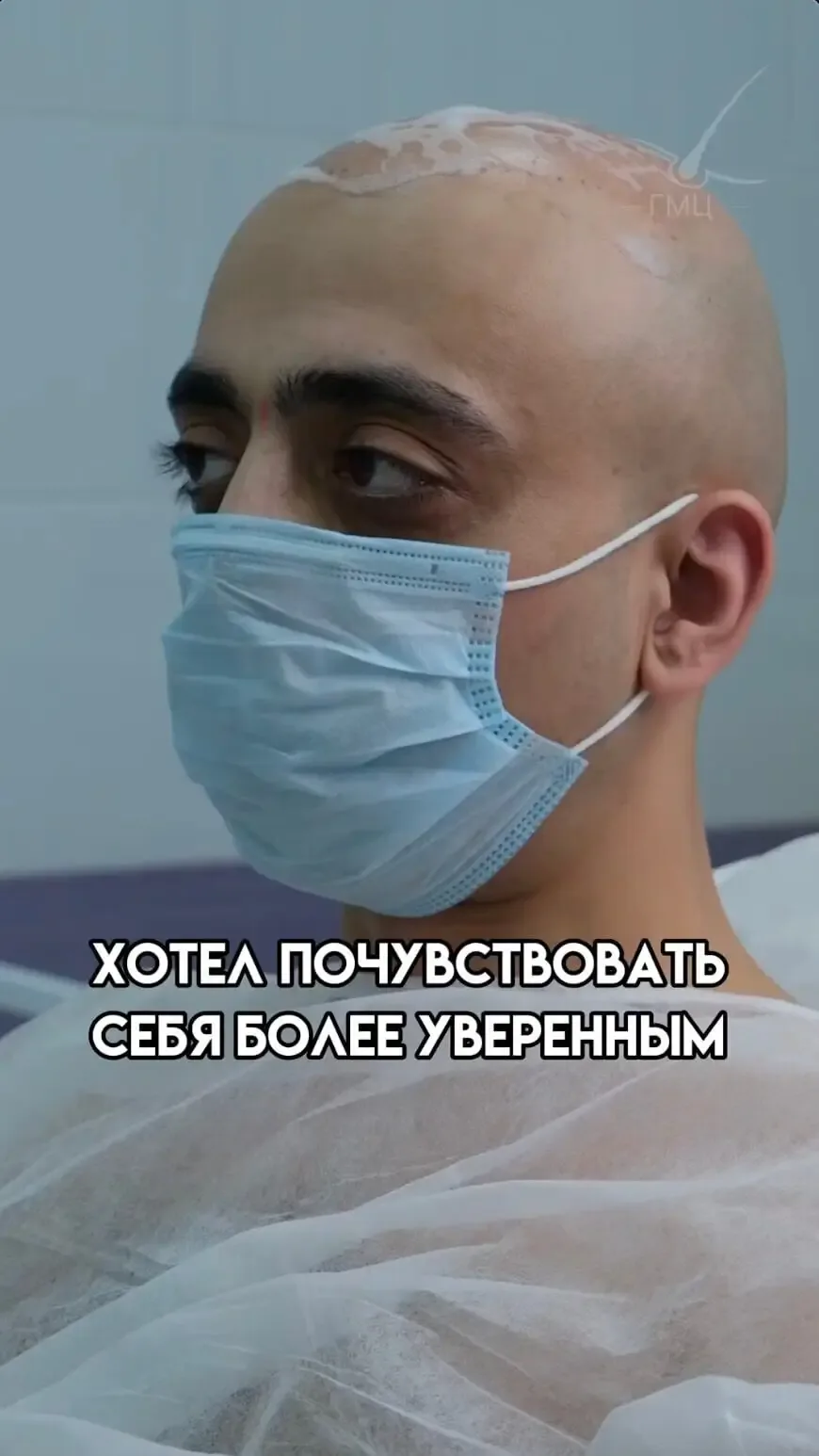 Отзыв пациента о трихопигментации: хотел почувствовать себя более уверенным