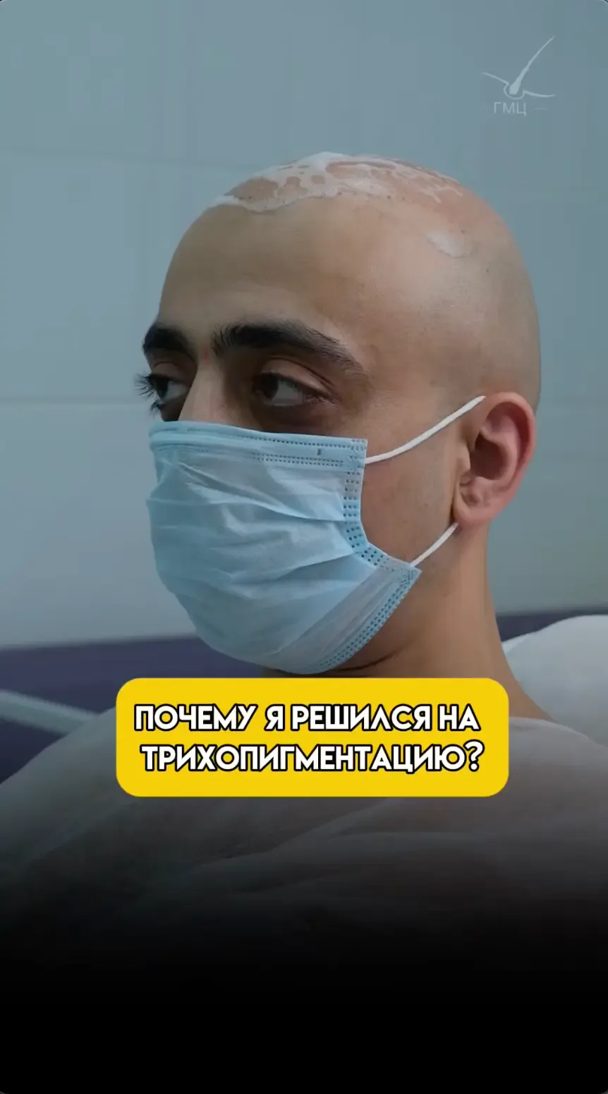 Отзыв пациента о трихопигментации: почему я решился на трихопигментацию